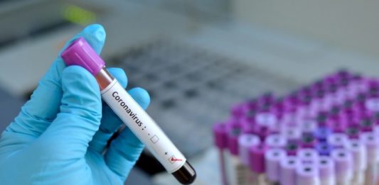 Teste pentru coronavirus COVID-19
