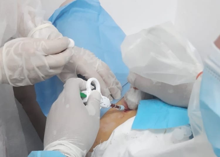 Biopsie ghidată ecografic prin metoda “true-cut”