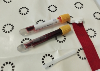 Analize spital foto Alexandra VASILE